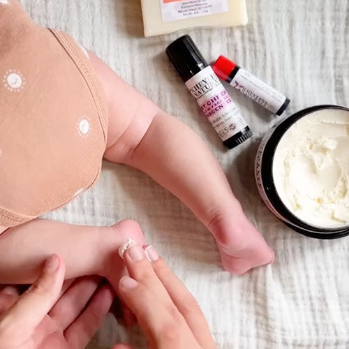 Person applying cream to a baby's leg with skincare products on a textured surface