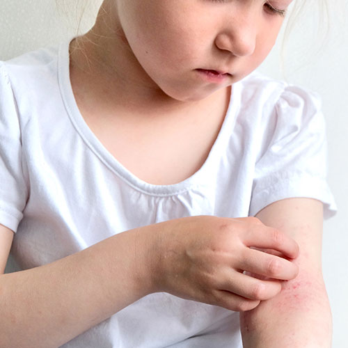 Child scratching an itchy arm with a white background